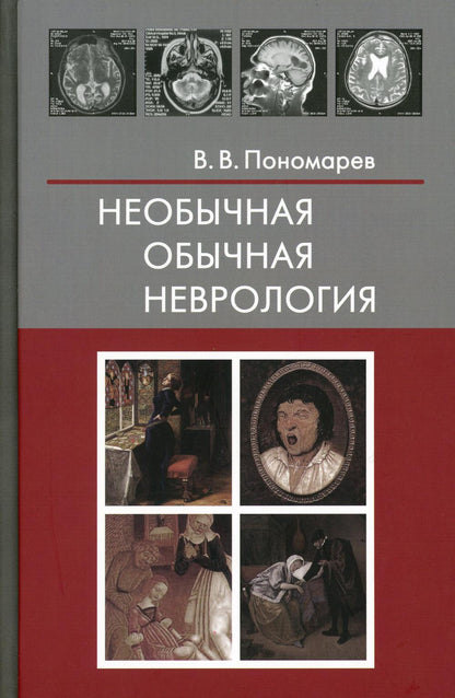 Необычная привычная неврология: руководство для врачей