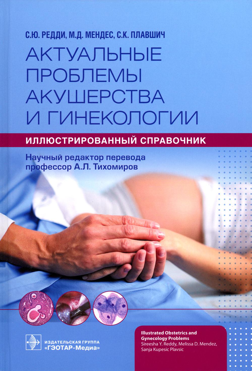 Актуальные проблемы акушерства и гинекологии: иллюстрированный справочник / С. Ю. Редди, М. Д. Мендес, С. Купешич Плавшич ; науч. ред. пер. А. Л. Тихомиров. — Москва : ГЭОТАР-Медиа, 2023. — 464 с. : ил.