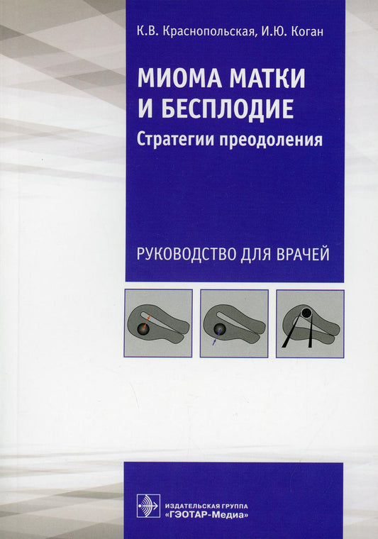 Миома матки и бесплодие: стратегии преодоления : руководство для врачей / К. В. Краснопольская, И. Ю. Коган. — Москва : ГЭОТАР-Медиа, 2021. — 144 с. : ил.