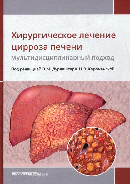 Хирургическое лечение цирроза печени: мультидисциплинарный подход: монография