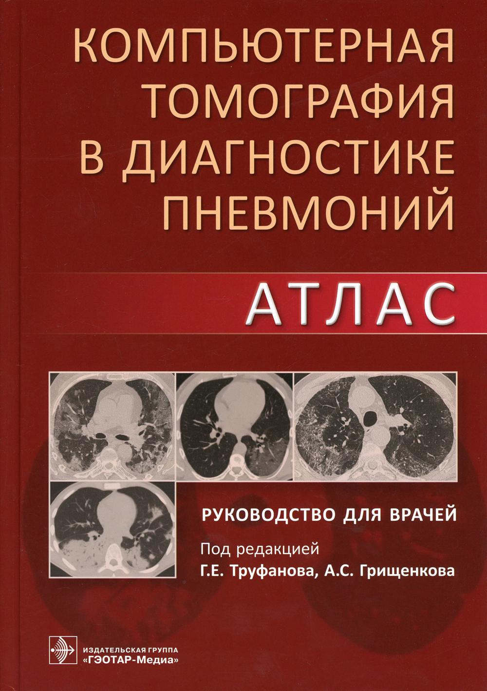 Компьютерная томография в диагностике пневмоний. Атлас : руководство для врачей / под ред. Г. Е. Труфанова, А. С. Грищенкова. — Москва : ГЭОТАР-Медиа, 2021. — 304 с. : ил.