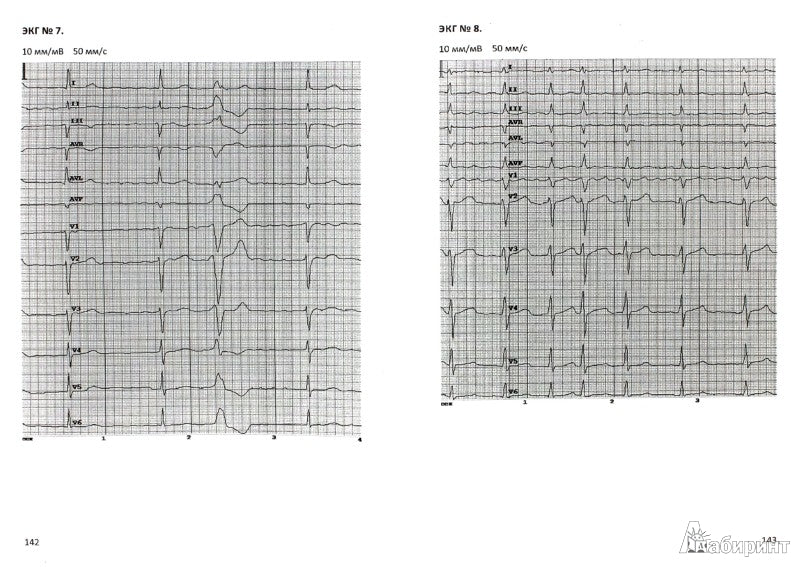 Электрокардиография: учеб. пособие