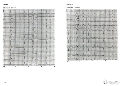 Электрокардиография: учеб. пособие