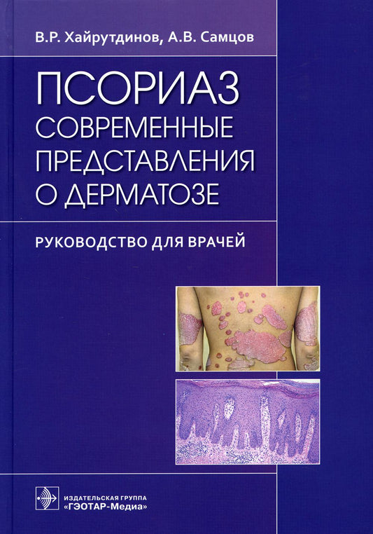 Псориаз. Современные представления о дерматозе : руководство для врачей / В. Р. Хайрутдинов, А. В. Самцов. — Москва : ГЭОТАР-Медиа, 2021. — 260 с.