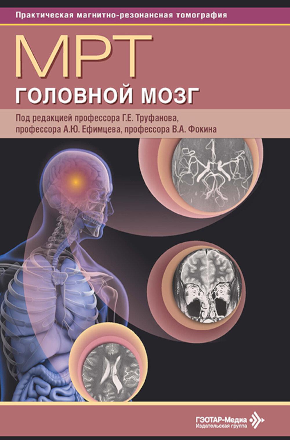 МРТ. Головной мозг: руководство для врачей