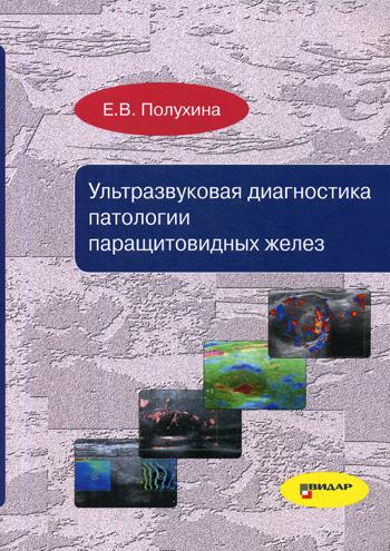 Ультразвуковая диагностика признаков паращитовидных желез (9253)