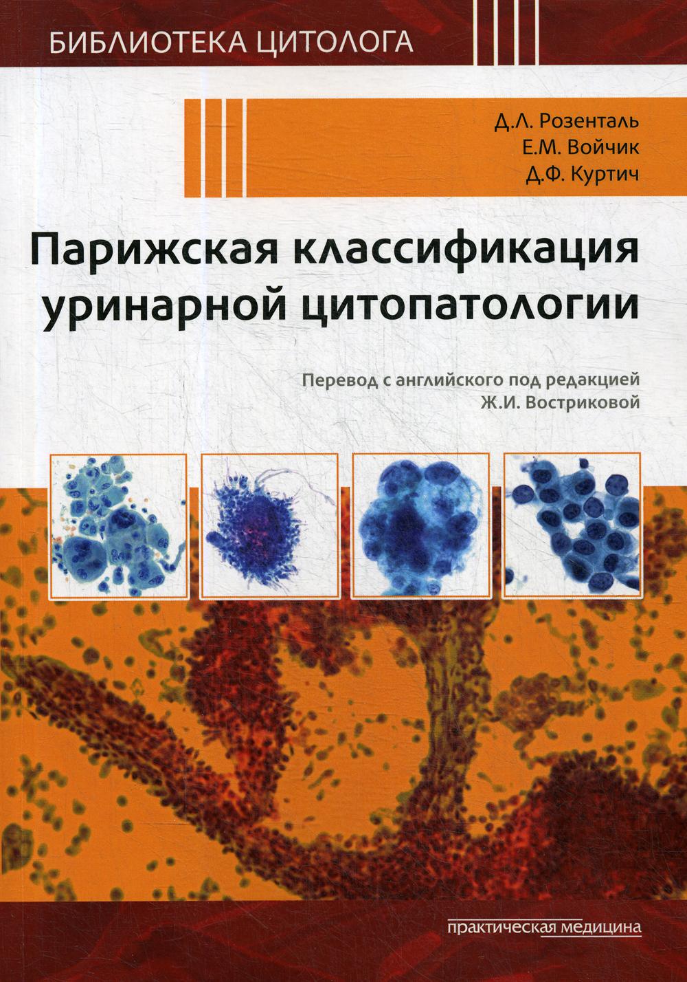 Парижская классификация уринарной цитопатологии