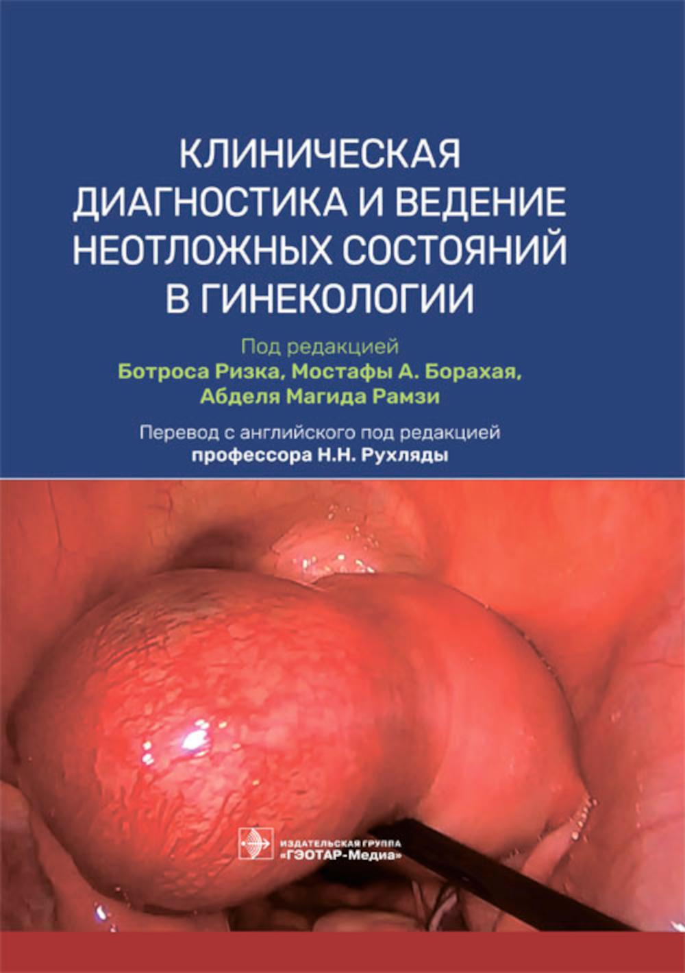Клиническая диагностика и ведение неотложных состояний в гинекологии / под ред. Б. Ризка, М. А. Борахая, А. М. Рамзи ; пер. с англ. под ред. Н. Н. Рухляды. — Москва : ГЭОТАР-Медиа, 2023. — 304 с. : ил.