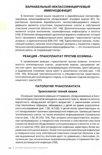 Интерпретация биопсии в педиатрии