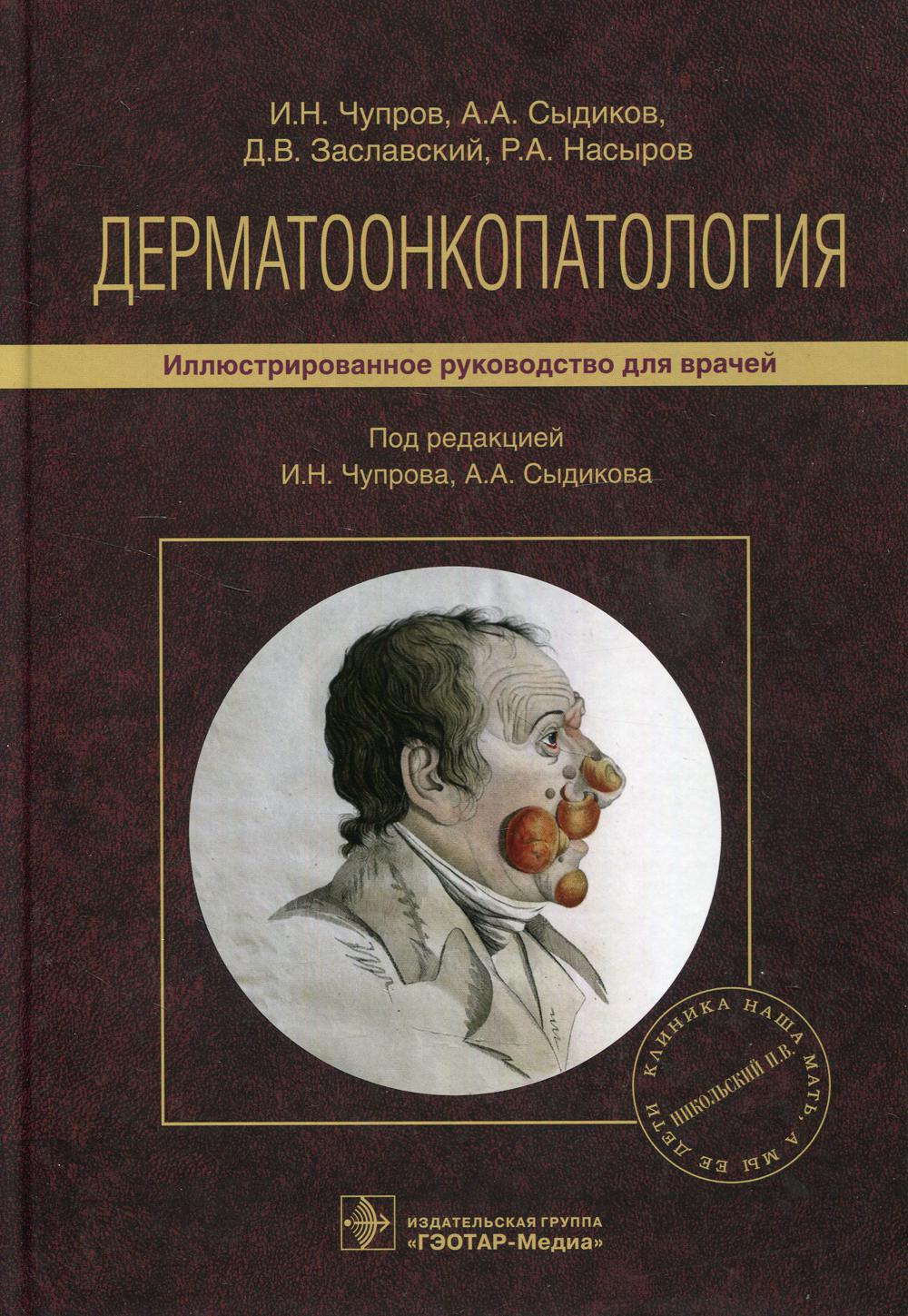 Дерматоонкопатология : иллюстрированное руководство для врачей / И. Н. Чупров, А. А. Сыдиков, Д. В. Заславский, Р. А. Насыров; под ред. И. Н. Чупрова, А. А. Сыдикова. — Москва : ГЭОТАР-Медиа, 2021. — 528 с. : ил.
