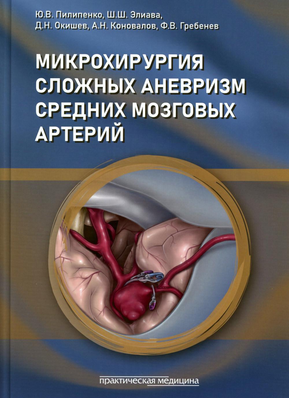 Микрохирургия сложных аневризм средних мозговых артерий: крупных, гигантских, фузиформных и частично тромбированных