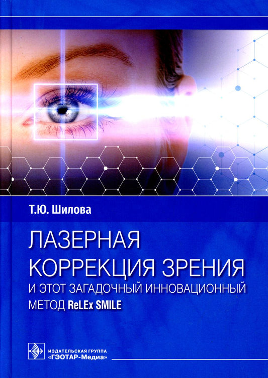Лазерная коррекция зрения и этот загадочный инновационный метод ReLEx SMILE / Т. Ю. Шилова. — Москва : ГЭОТАР-Медиа, 2022. — 240 с. : ил.