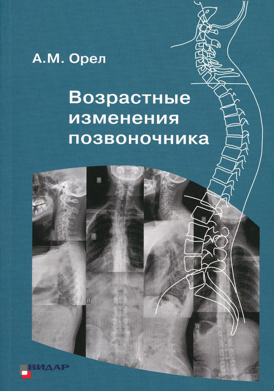 Возрастные изменения окраса Орел А.М.