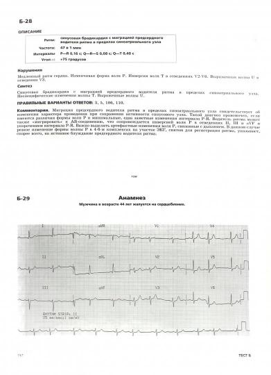 Клиническая электрокардиография. 2-е изд