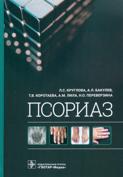 Псориаз / Л. С. Круглова, А. Л. Бакулев, Т. В. Коротаева [и др.]. — Москва : ГЭОТАР-Медиа, 2022. — 320 с. : ил.