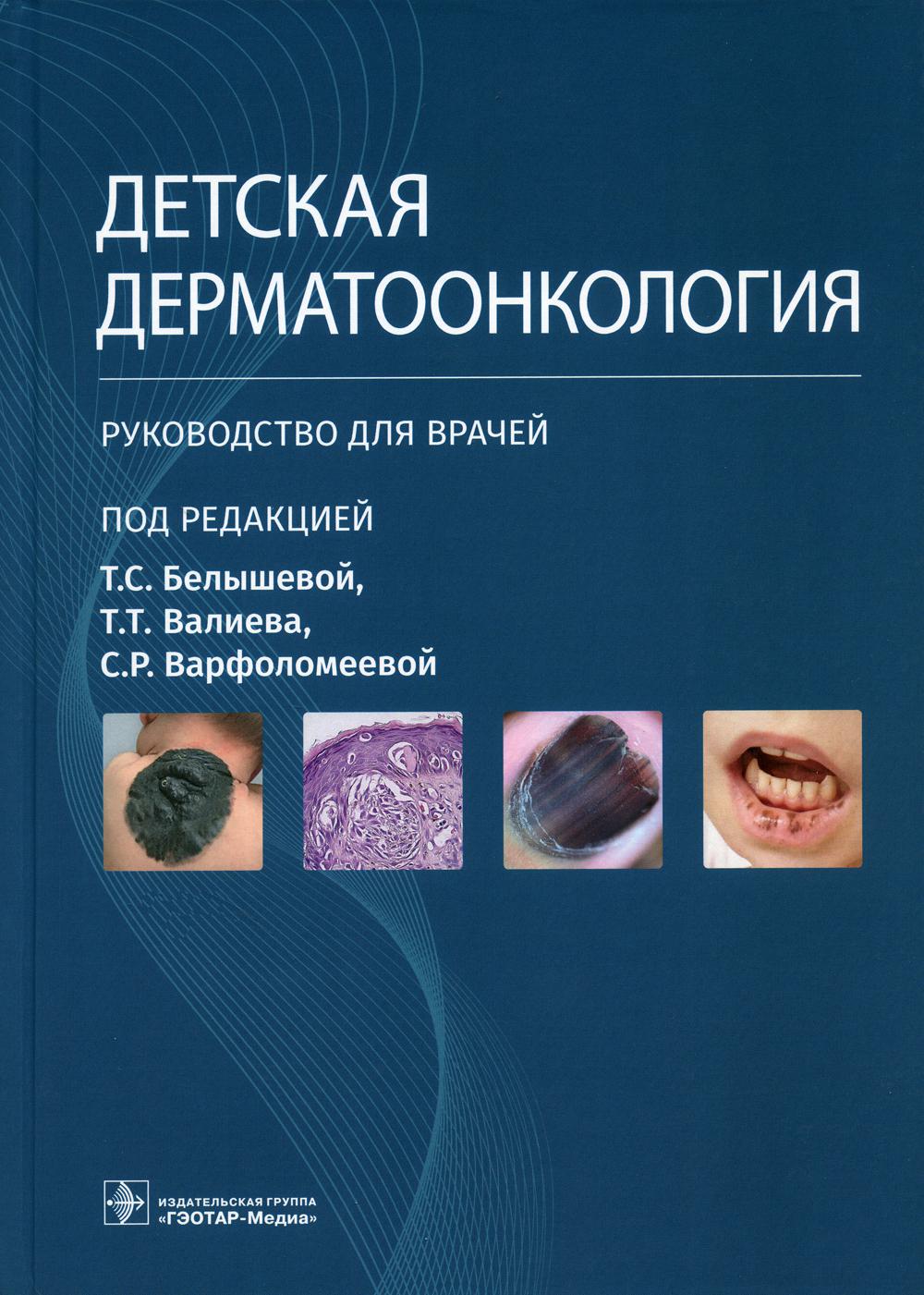 Детская дерматоонкология : руководство для врачей / под ред. Т. С. Белышевой, Т. Т. Валиева, С. Р. Варфоломеевой. — Москва : ГЭОТАР-Медиа, 2023. — 280 с. : ил.