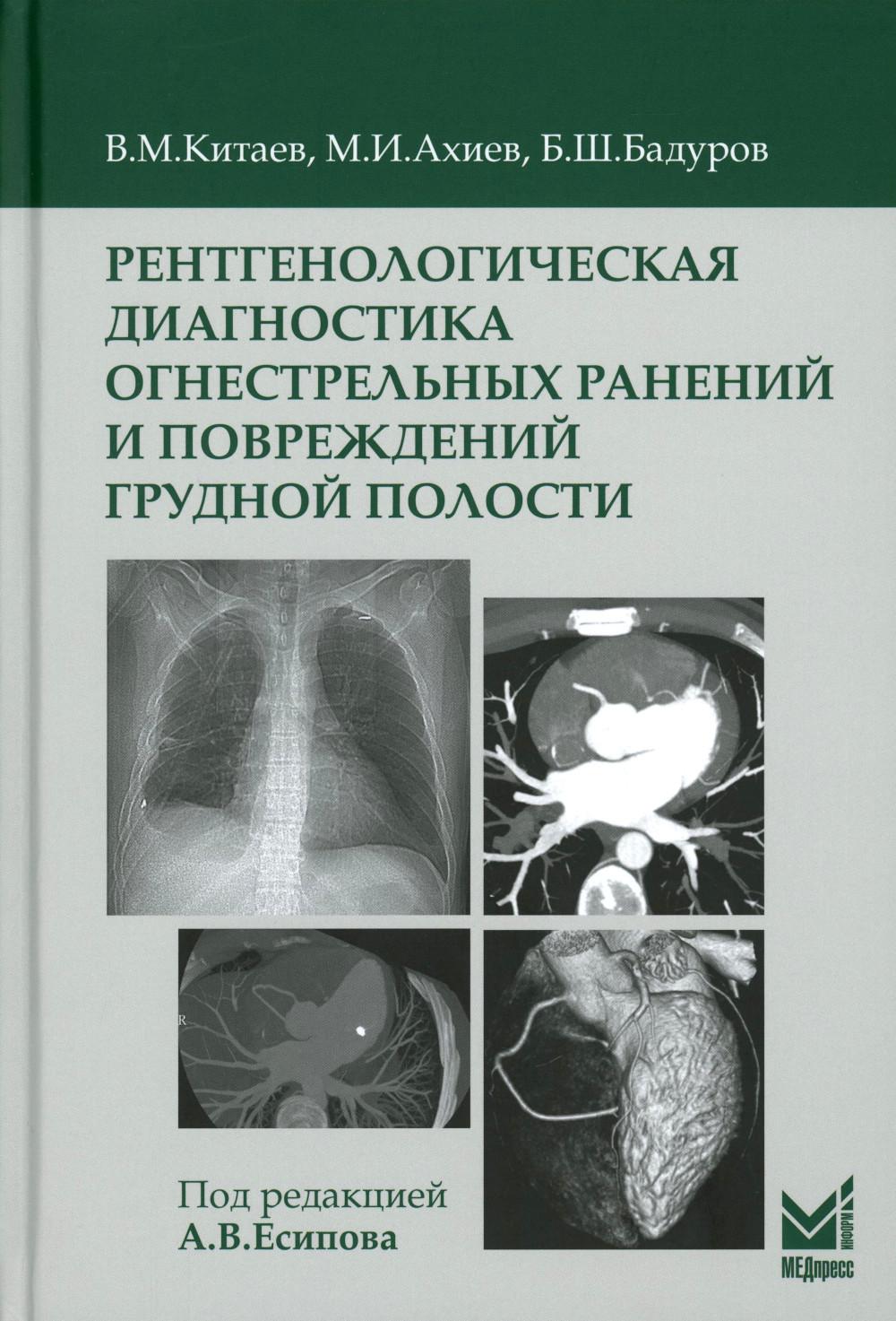 Рентгенологическая диагностика огнестрельных ранений и повреждений грудной полости. 2-е изд., перераб. и доп
