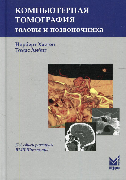 Компьютерная томография головы и шеи. 3-е изд
