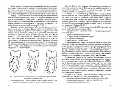 Резекция верхушек корней зубов - лечение периапикальных процессов: Учебное пособие