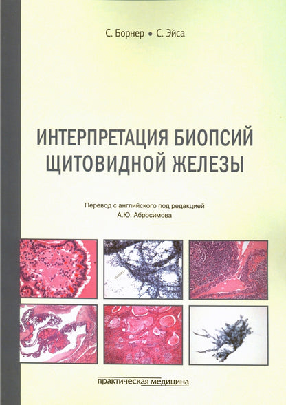 Интерпретация биопсий щитовидной железы