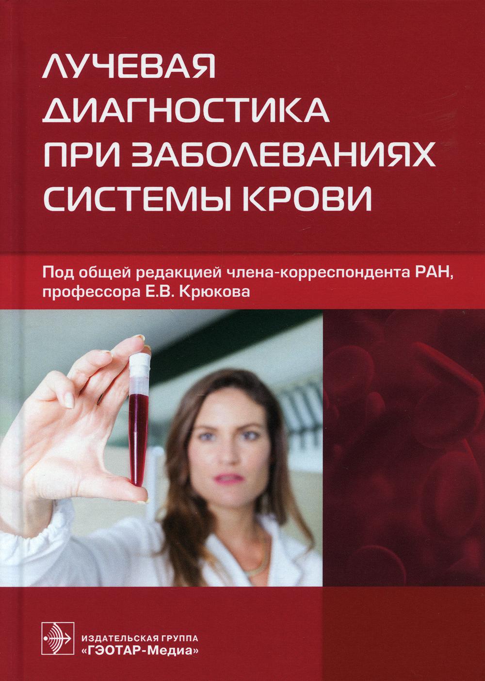 Лучевая диагностика при заболеваниях системы крови (В рук-ве представлен широкий спектр сведений, касающихся лучевой диагностики заболеваний системы крови. Охарактеризованы патологические изменения органов и тканей, выявляемые всеми доступными методами лу