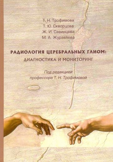 Радиология церебральных глиом: диагностика и мониторинг