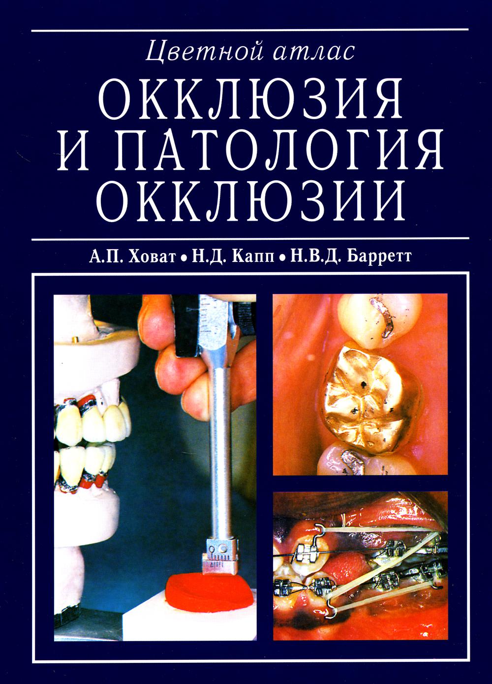 А.П. Ховат, Н.Д.Капп "Окклюзия и патология окклюзии. Цветной атлас. М., 2005