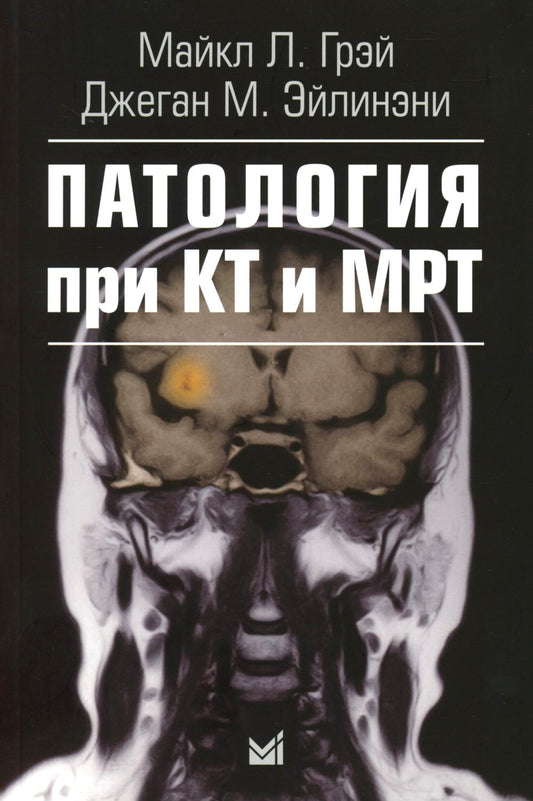 Патология при КТ и МРТ. 3-е изд