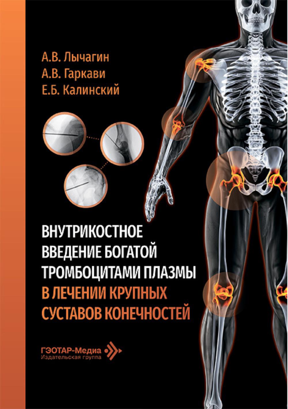 Внутрикостное введение богатой тромбоцитами плазмы в лечении крупных суставов конечностей / А. В. Лычагин, А. В. Гаркави, Е. Б. Калинский [и др.]. — Москва : ГЭОТАР-Медиа, 2026. — 96 с. : ил.