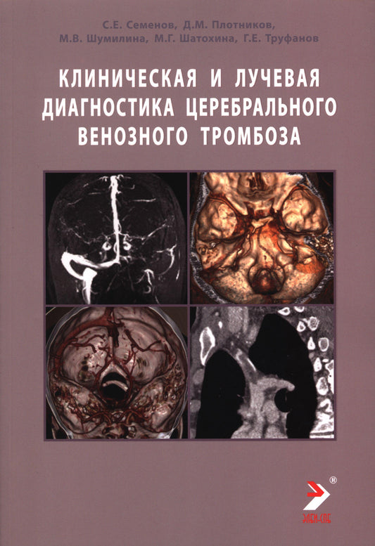 Клиническая и лучевая диагностика церебрального венозного тромбоза: Учебное пособие