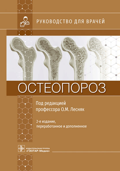 Остеопороз : руководство для врачей / под ред. О. М. Лесняк. — 2-е изд., перераб. и доп. — Москва : ГЭОТАР-Медиа, 2023. — 752 с. : ил.