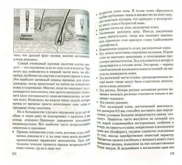 Клещи домашней пыли - белое пятно в медицине