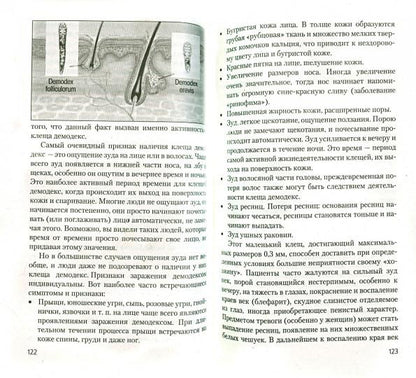 Клещи домашней пыли - белое пятно в медицине