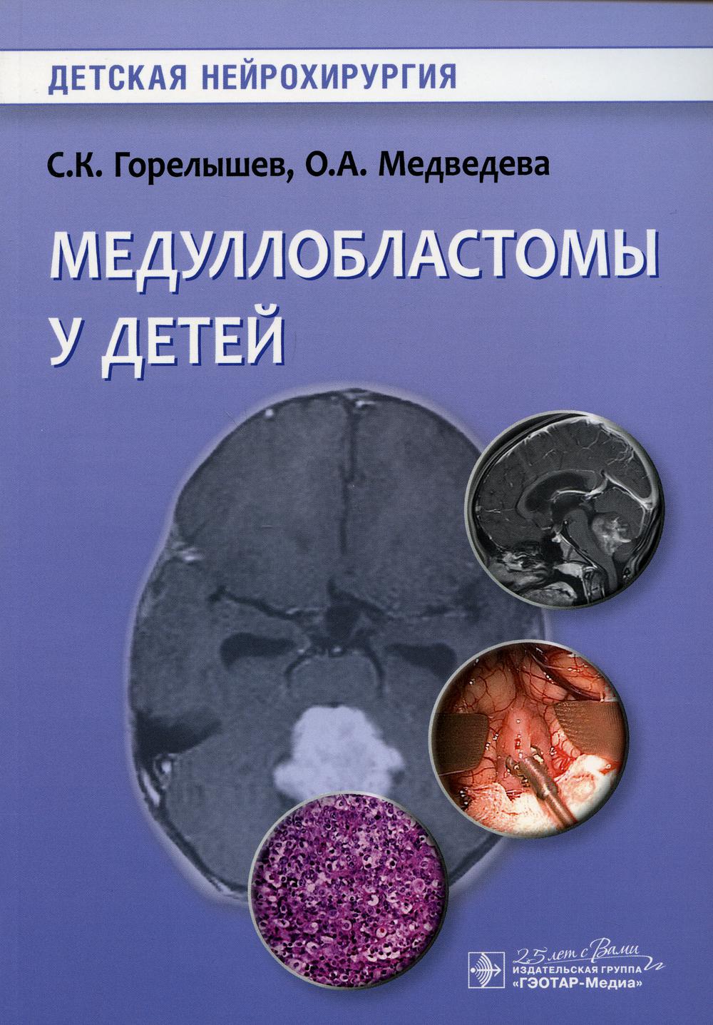 Медуллобластомы у детей / С. К. Горелышев, О. А. Медведева [и др.]. — Москва : ГЭОТАР-Медиа, 2020. — 224 с. : ил. — (Серия «Детская нейрохирургия»). — DOI: 10.33029/9704-5425-1-MC-2020-1-208.